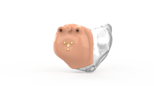 Sol_Ouvir-aparelhos-auditivos-aparelho-itc-bege